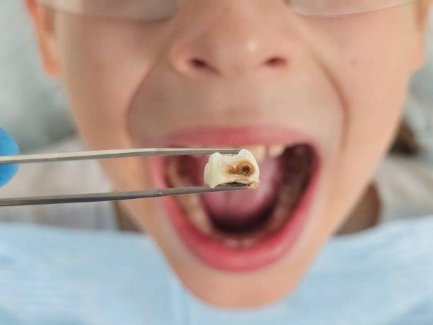 Best Emergency Dental Services for Seniors in Vincent, AL