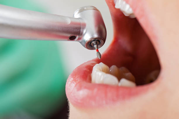 Best Broken or Cracked Tooth Emergency Dentist in Vincent, AL